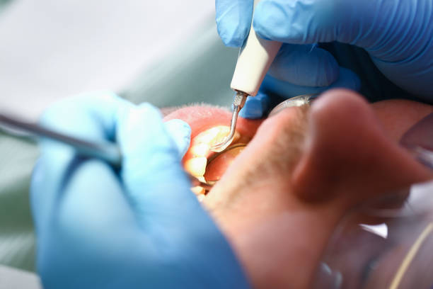 Best Emergency Gum Pain Relief  in Twin Lakes, VA