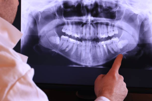 Best Chipped Tooth Repair Near Me  in Twin Lakes, VA
