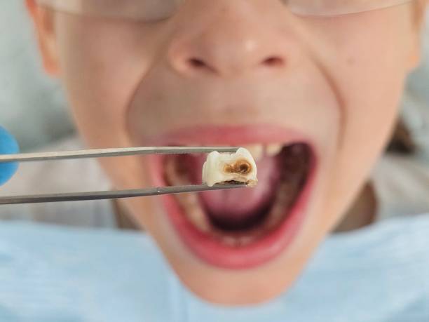 Best Dentist Open Late Near Me  in Twin Lakes, VA